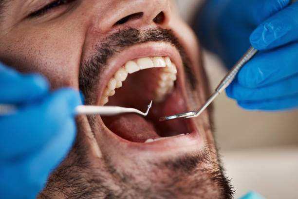 Best Teeth Whitening  in Mcgovern, PA
