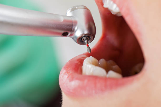 Best Dentist for Dental Trauma  in Mcgovern, PA